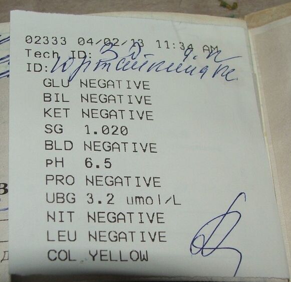 Moje analýza moči má za následek před femixal